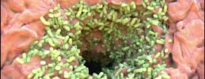 microbiota malattie della pelle